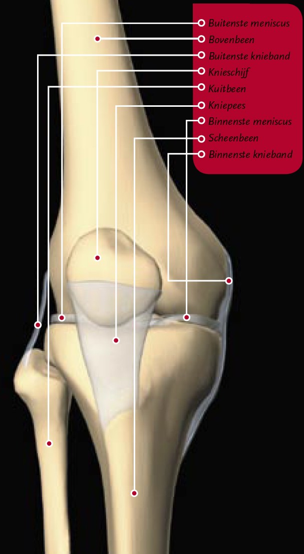 Scheur in de meniscus
